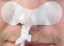 Grip-Lok Large Nasal Gastric Securement Sterile